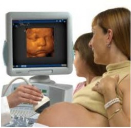 Ultrazvukové vyšetření ve 4D obraze
